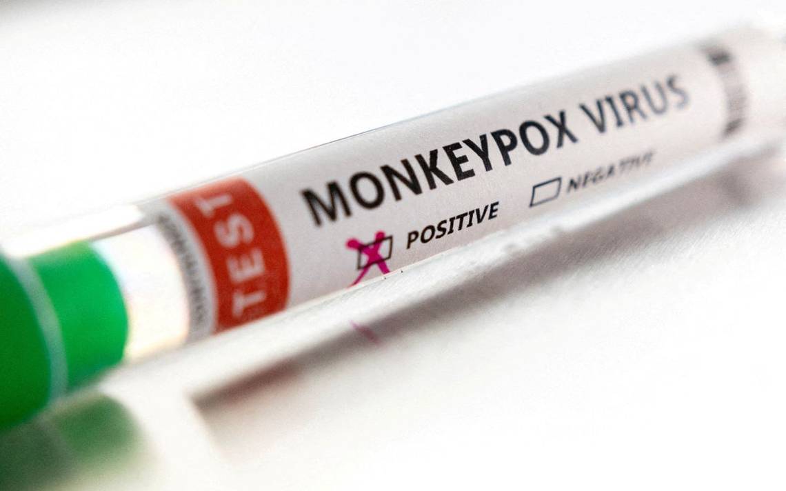 OMS pide vigilancia y transparencia ante casos de viruela del mono